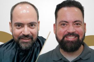 Asociado CCL: Conoce a Integral Hair, la clínica de restauración capilar que cambiará tu vida