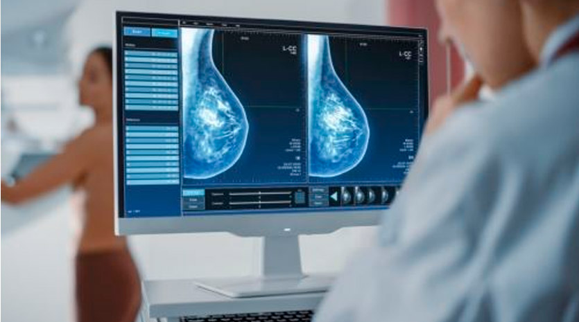 Licencia para descarte de cáncer de mama y cuello uterino