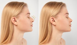 ¿Buscas productos de estética corporal y facial? Instantbelle, asociado CCL, hace envíos a todo el Perú